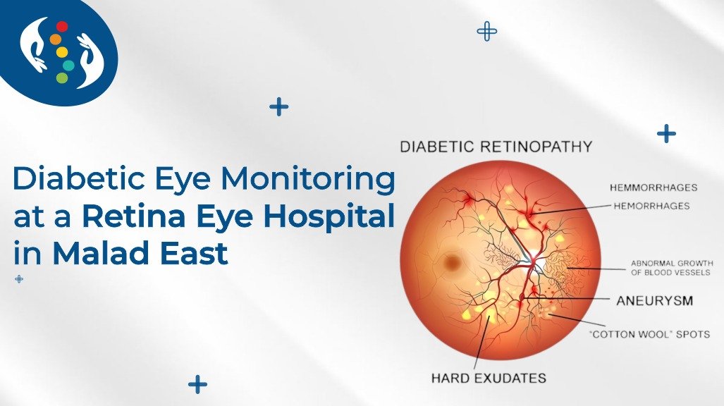 Diabetic eye monitoring and retinal screening